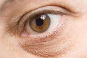 Причины образования глазной грыжи