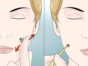  Как сделать ямочки на лице