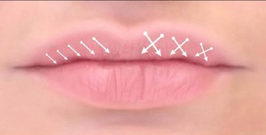 Возможные техники коррекции формы губ и их объема
