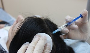 Мезотерапия для волос - проведение