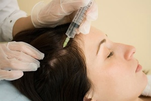 Мезотерапия - революционный метод лечения волос.