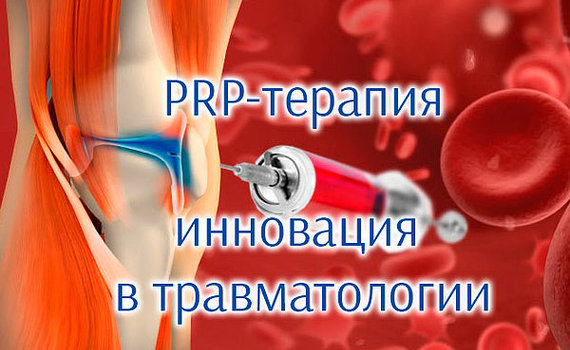 Platelet Rich Plasma: суть ПРП-терапии
